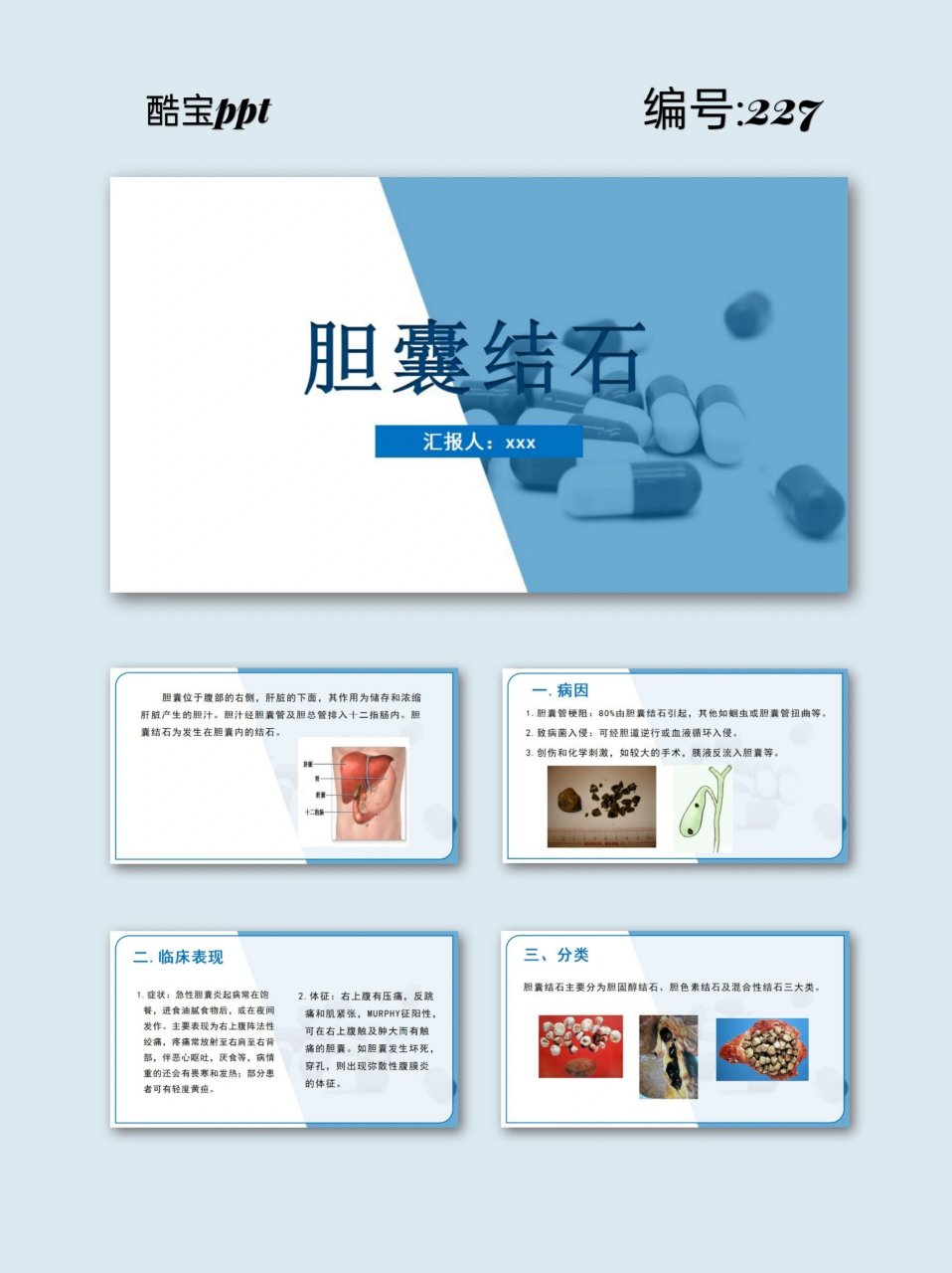 227带内容|胆囊结石ppt模板 92编号:227 92页数:24,可编辑修改