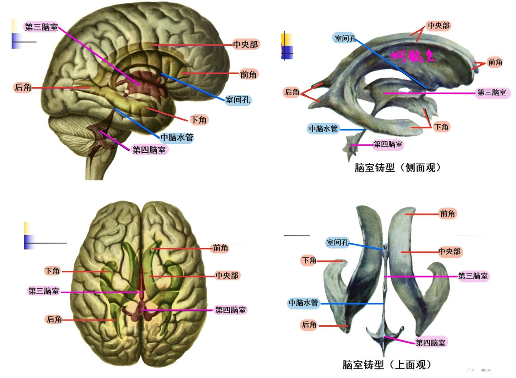 解剖总结 大脑 脑沟脑回 脑室 脑池 大脑横断面解剖 大脑冠状面解剖