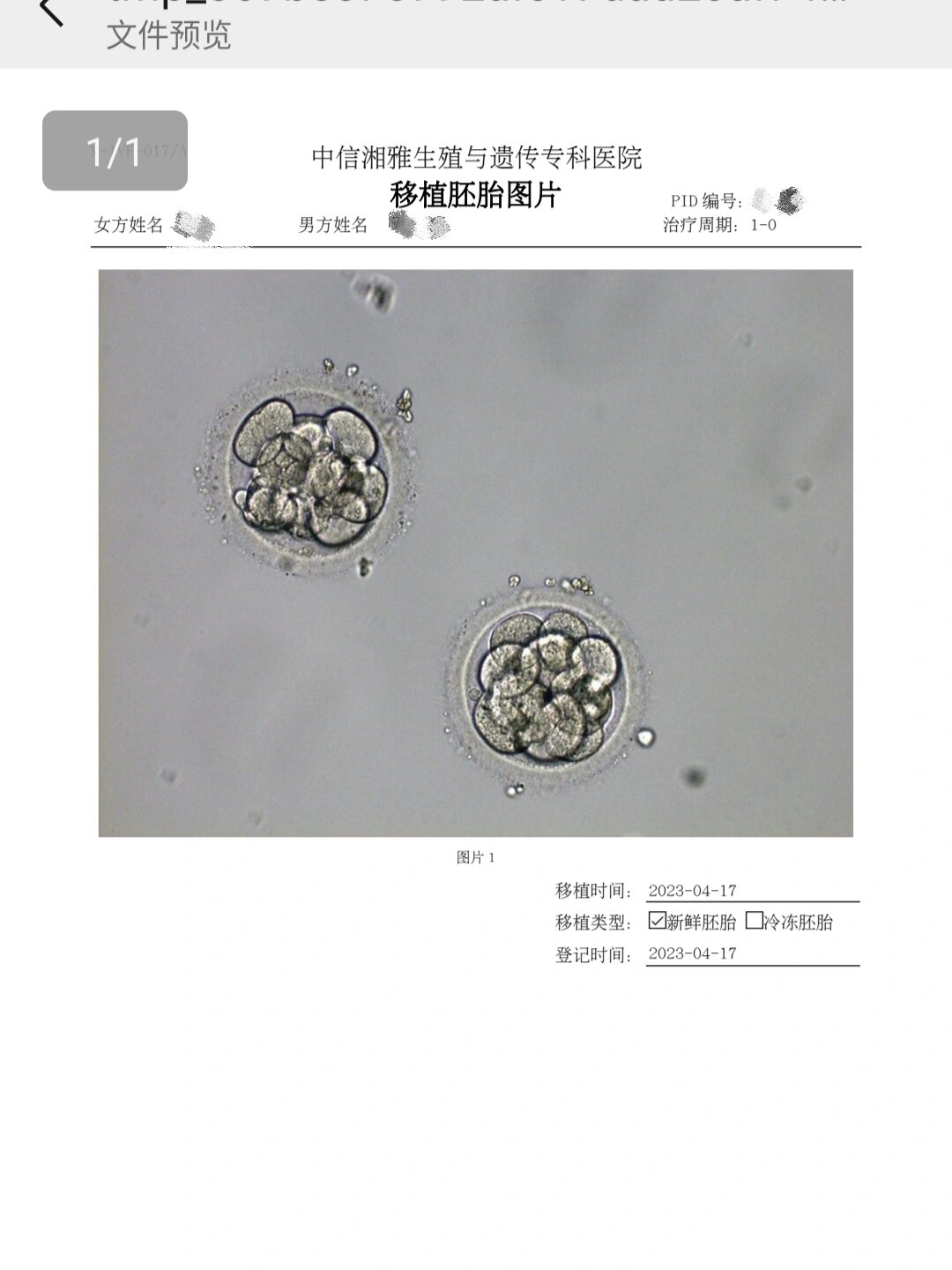 试管移植第三天胚胎图图片