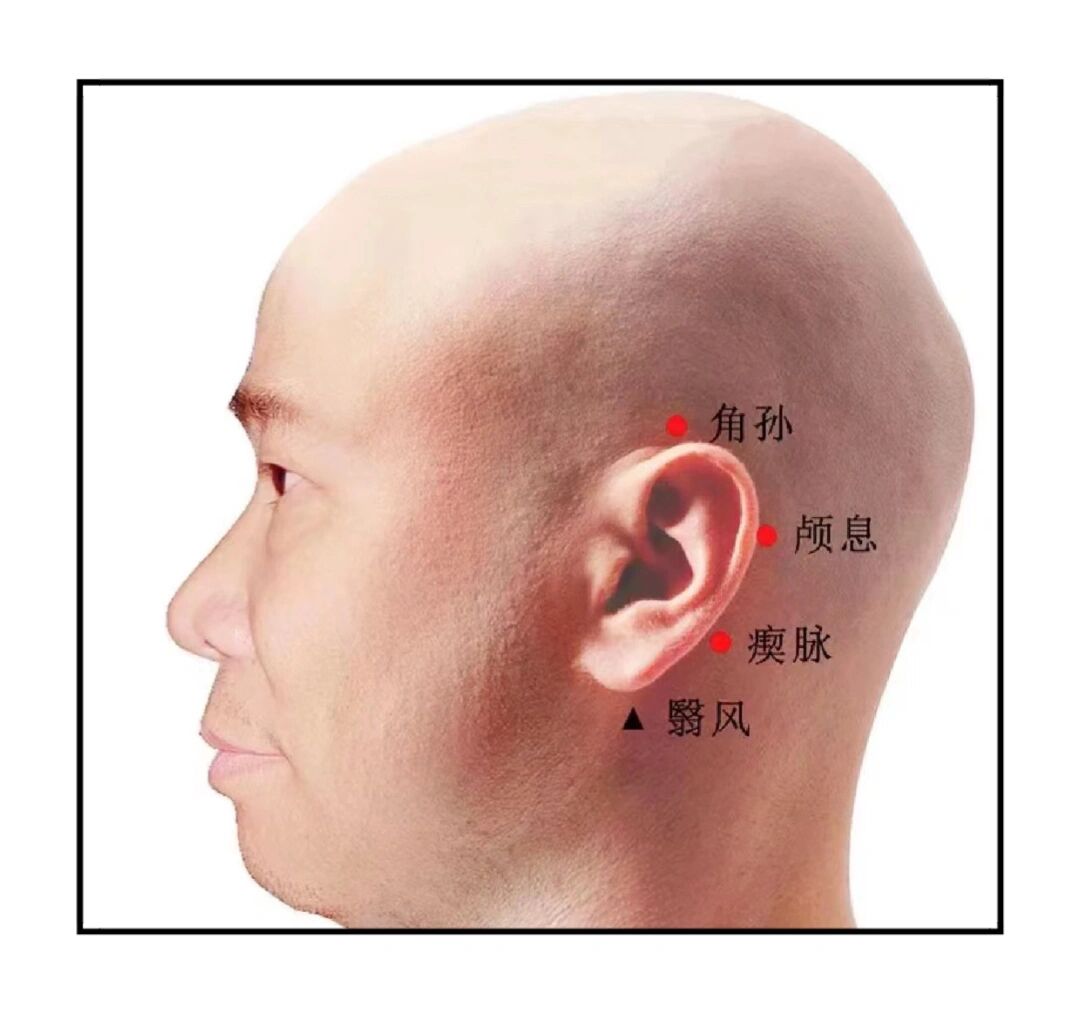 额的位置图图片