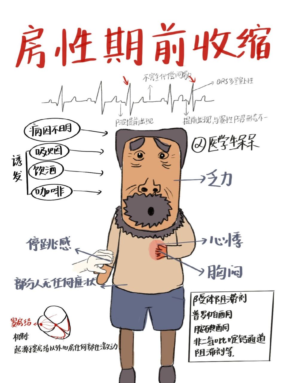 医学生笔记|房性期前收缩(房早) 今天复习房早,房早也是心律失常中最