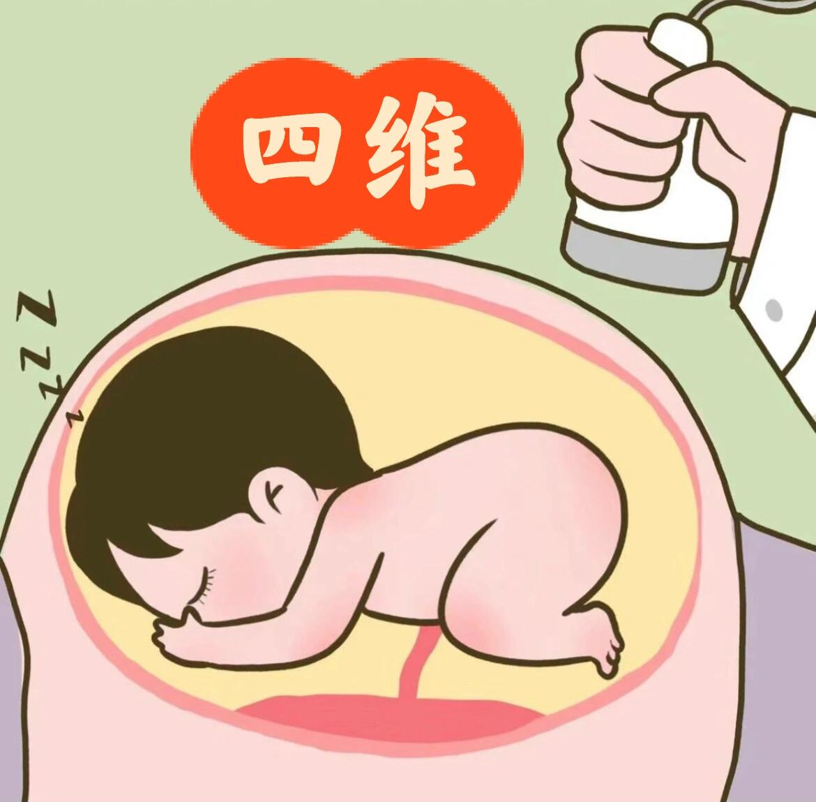 四维都做了几次