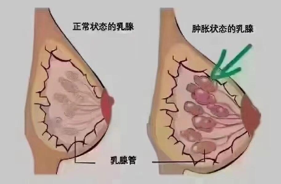 左侧乳11点位置图图片