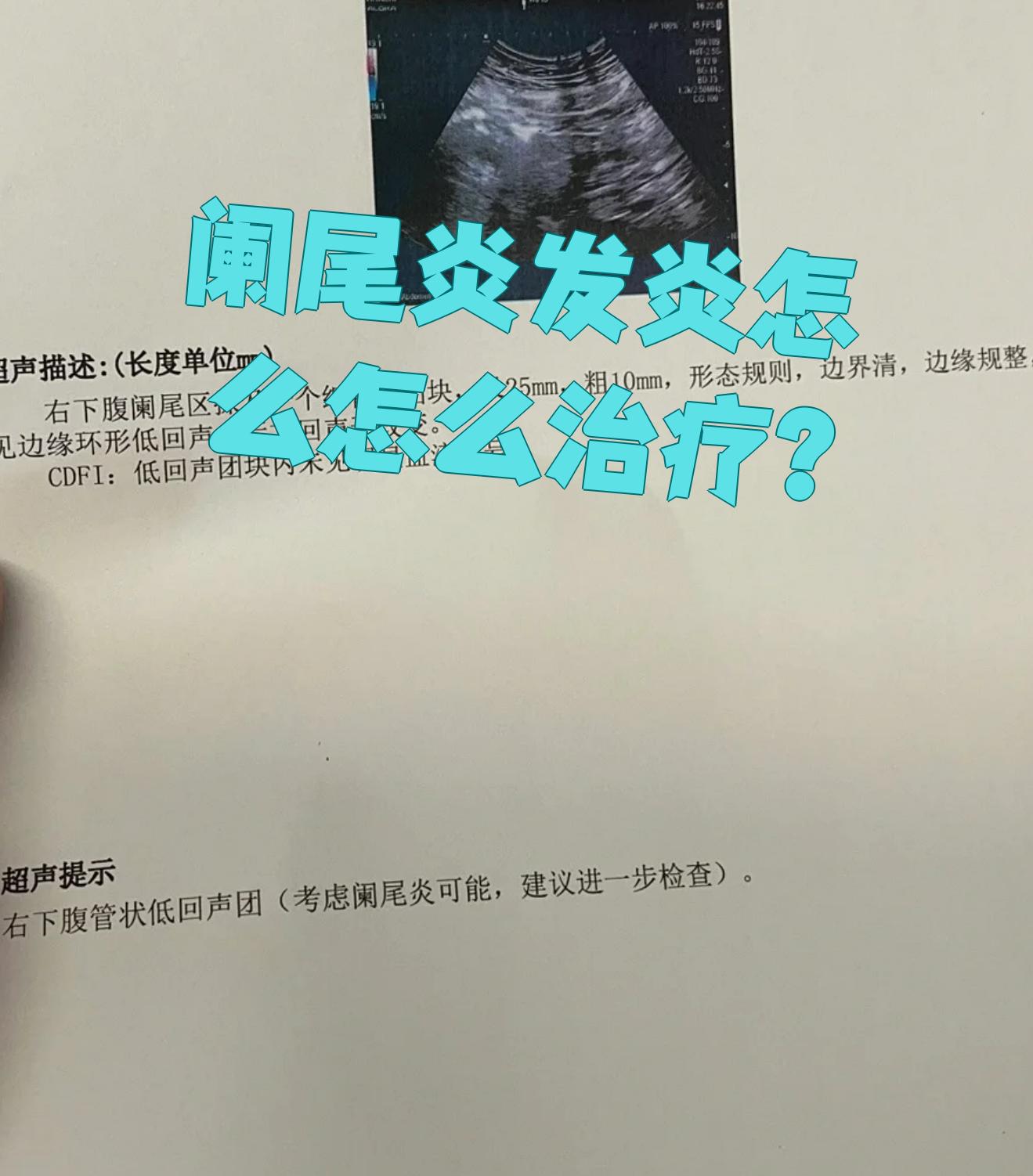 阑尾炎发炎怎么怎么治疗?