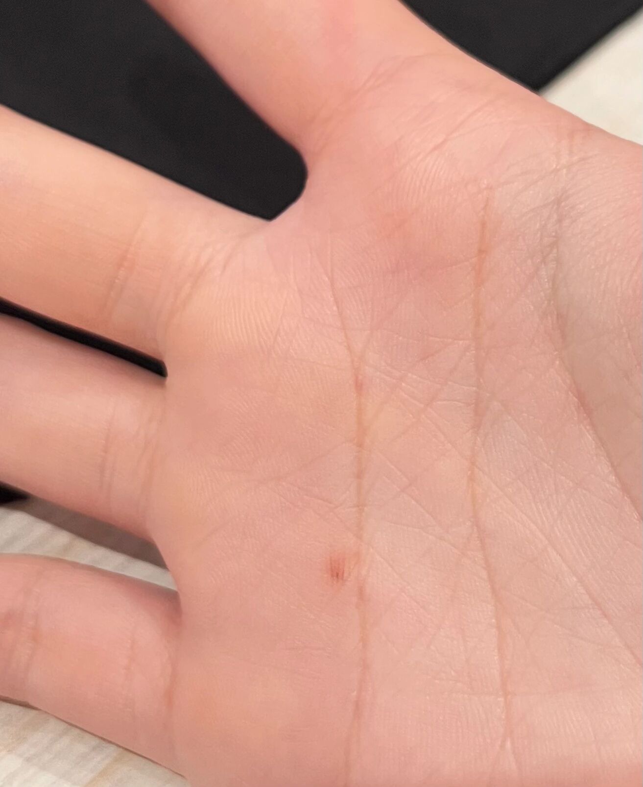 这个痣已经快模糊的没了还要切吗 看到很多姐妹说痣要切,大家帮我看看