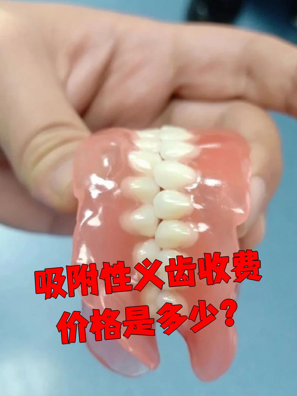 假牙的种类及价格,假牙的种类及价格可以医保么