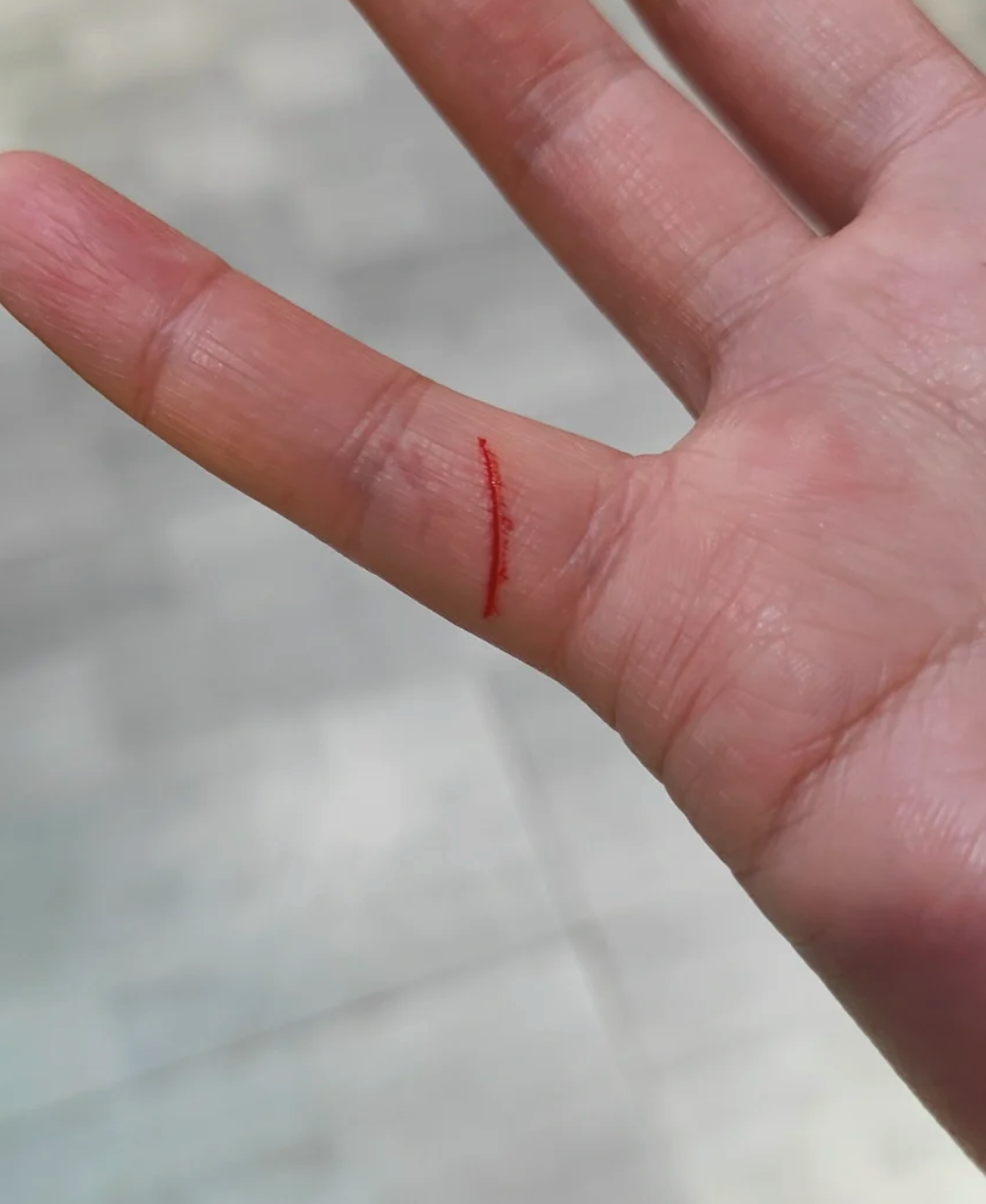 手指划伤后要马上处理,先消毒再用药