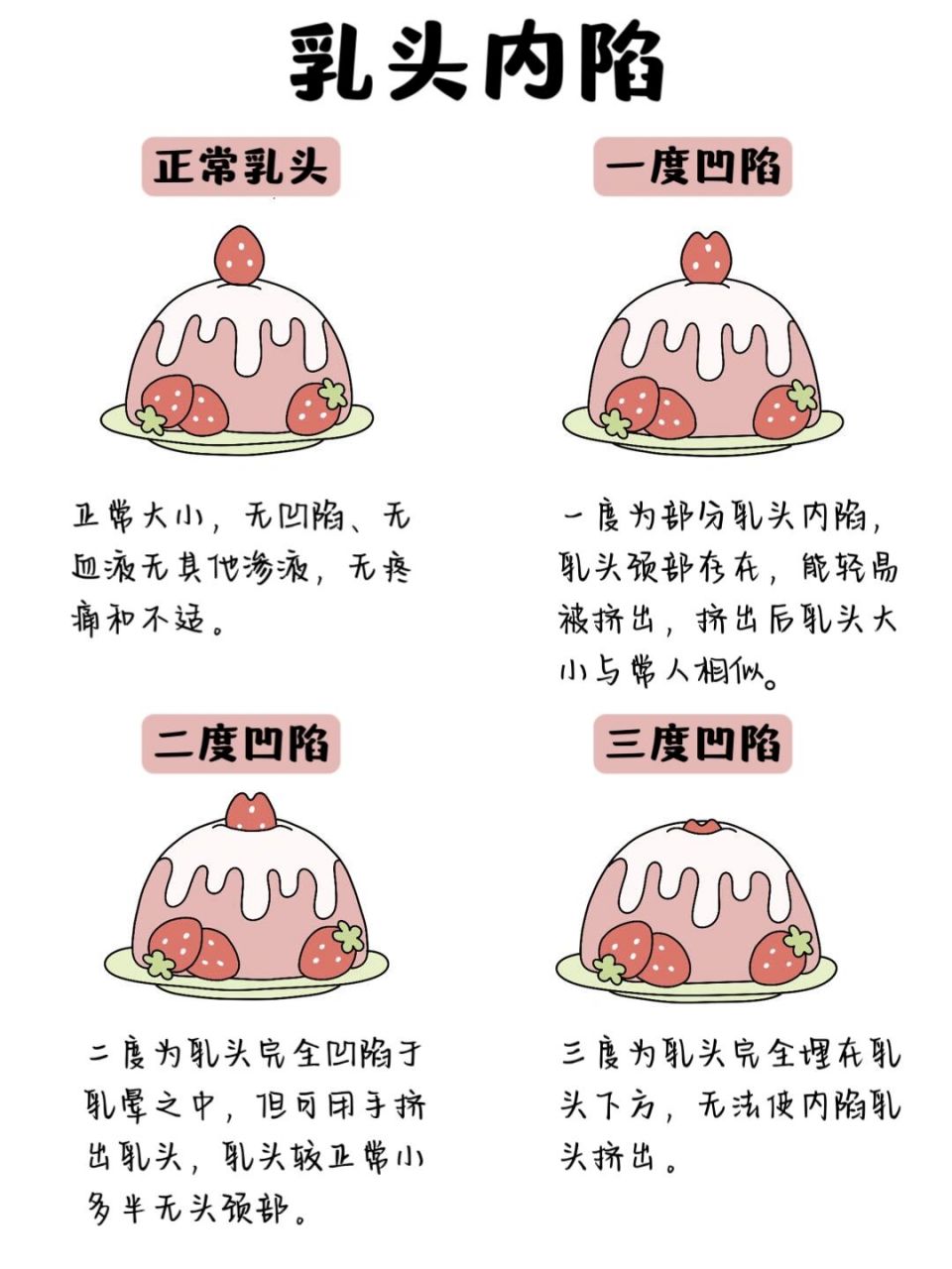 手写笔记94/乳头内陷 乳头内陷是一种比较常见的乳房畸形,是指乳房