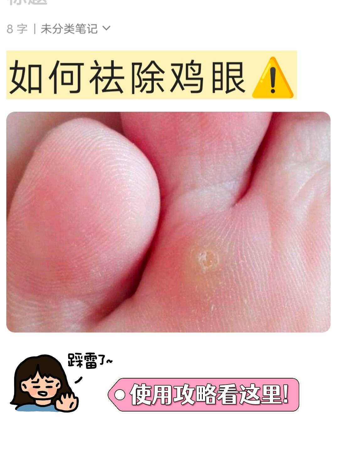 赶紧收藏 选鸡眼贴一定要擦亮眼睛