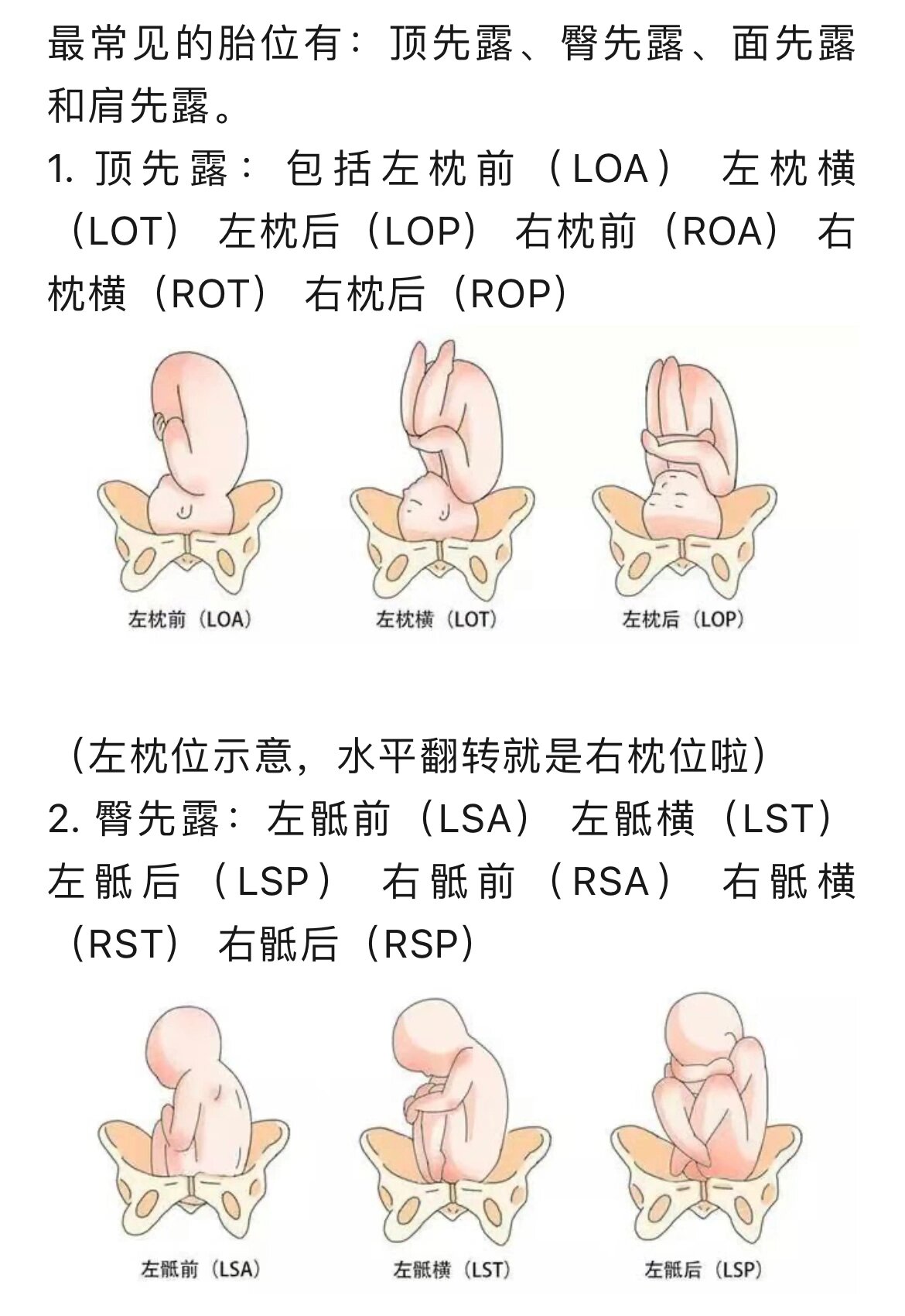 loa胎位图片