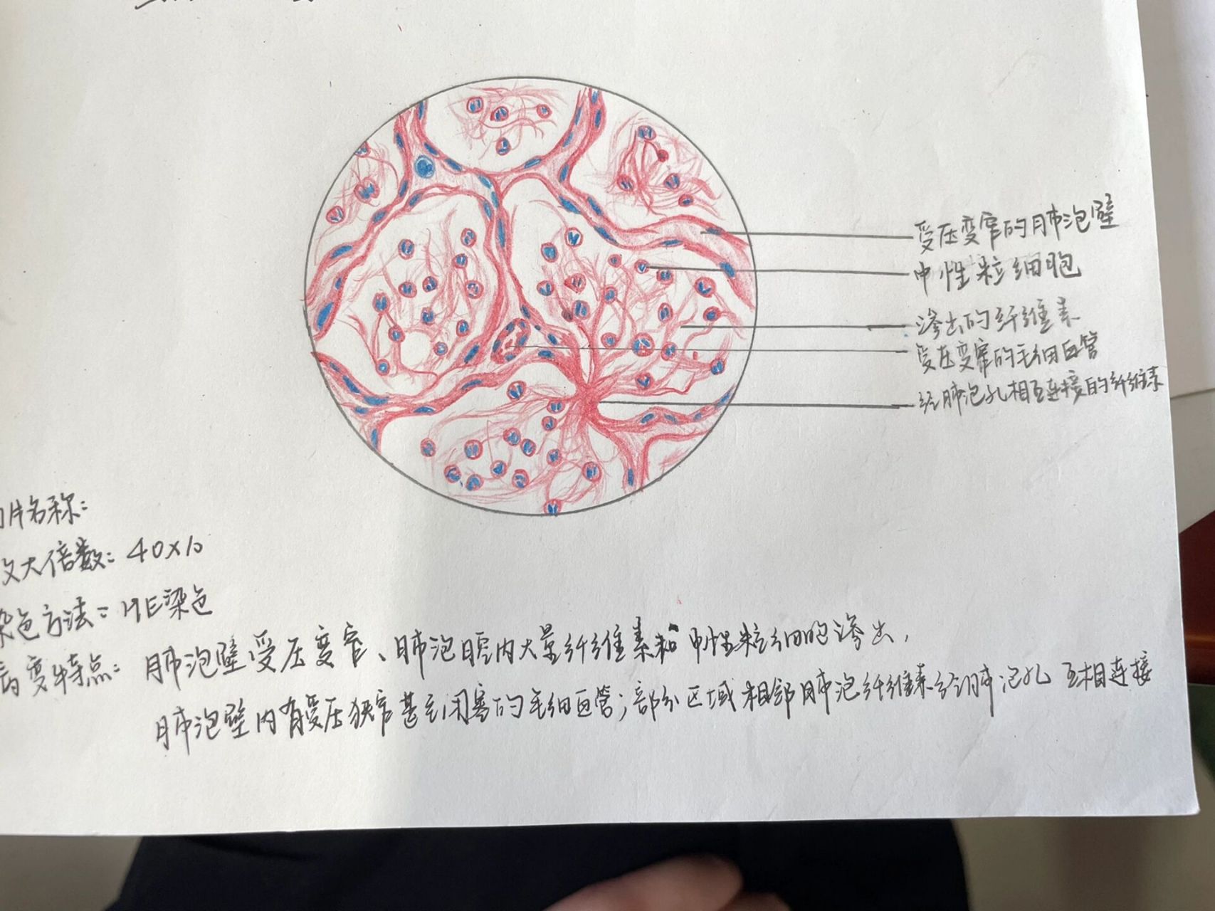 病理实验|呼吸系统疾病,心血管疾病绘图 p1 大叶性肺炎灰肝绘图 p2