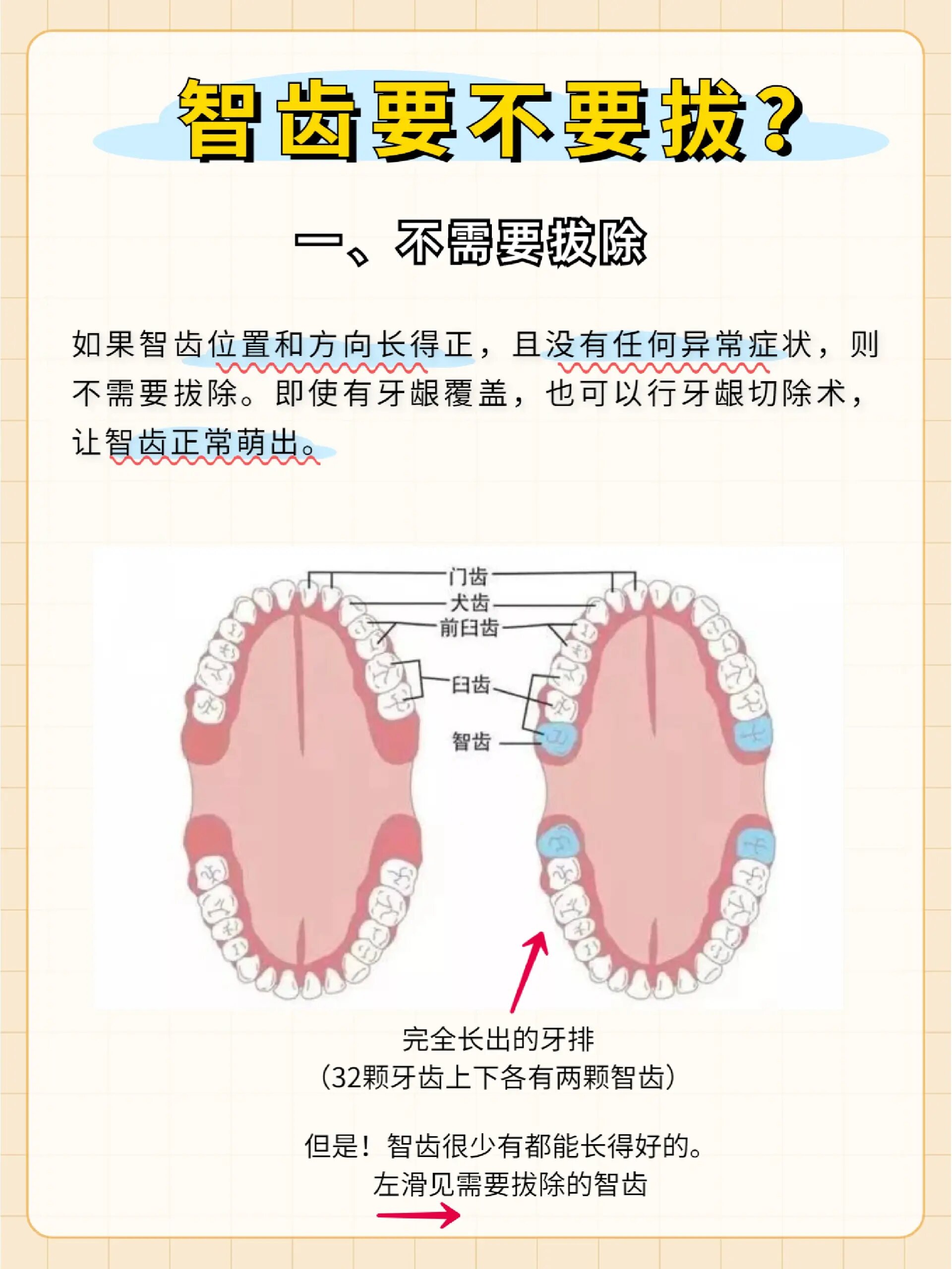 智齿分类图片