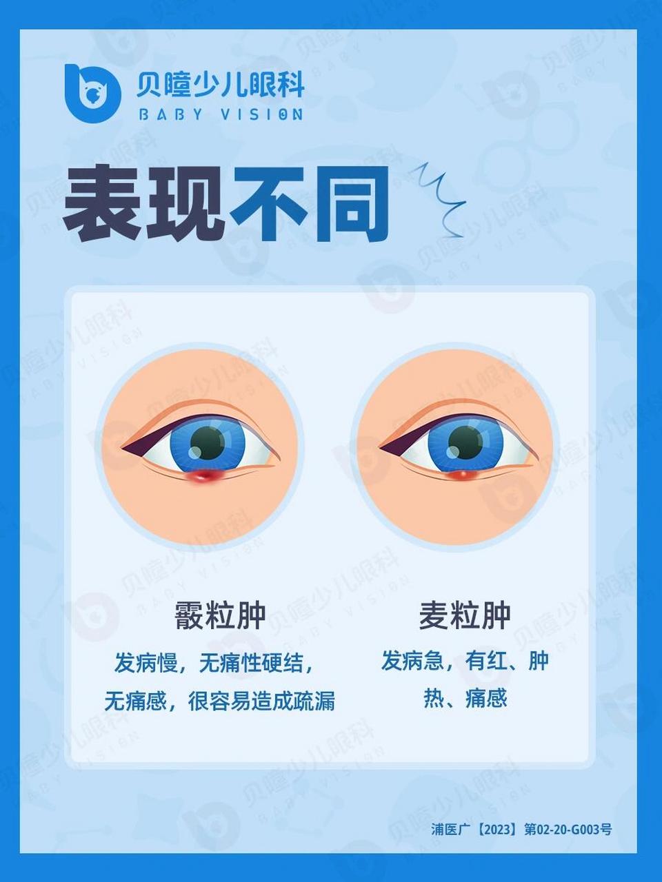 原来差别这么大‼ 1⃣病因不同 麦粒肿和霰粒肿是两种常见的眼疾