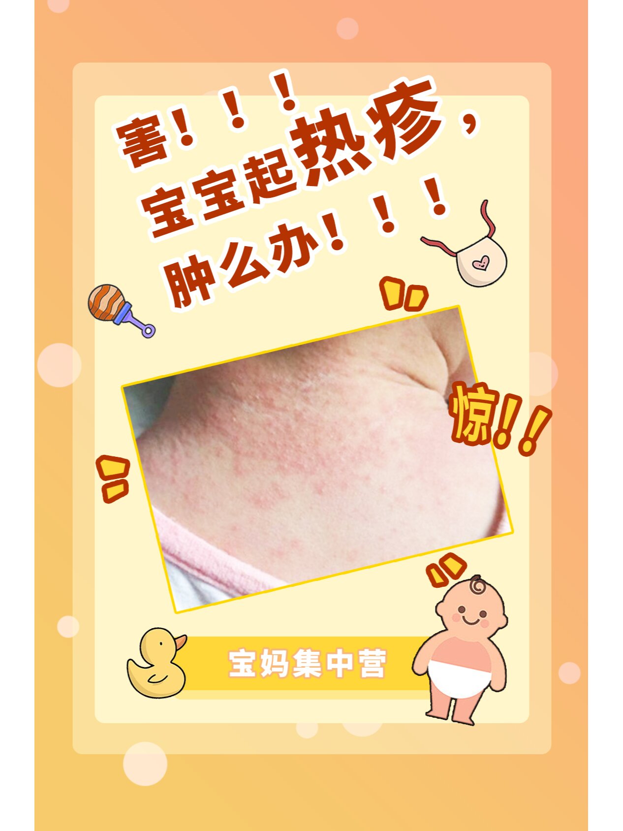 去除婴儿热疹小妙招、婴儿热疹怎么处理好得快