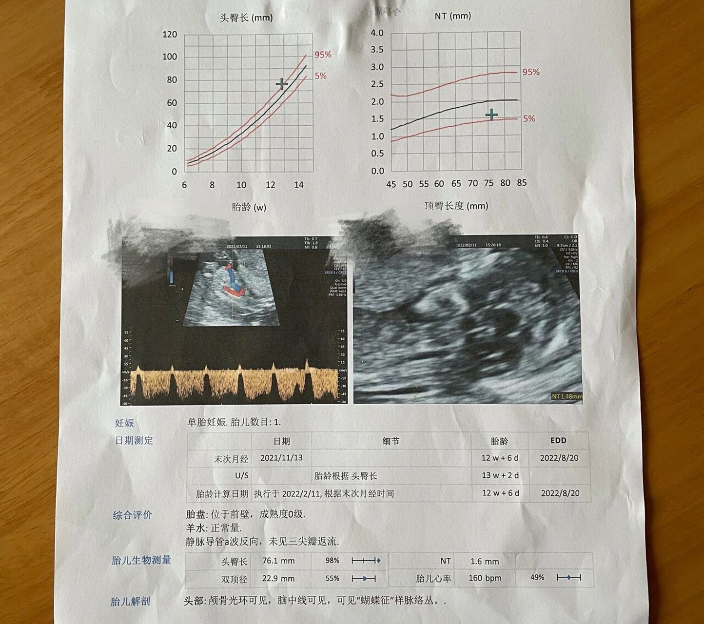 13周孕记 nt检查静脉导管a波反向 正准备开始吃叶酸备孕发现怀孕了.