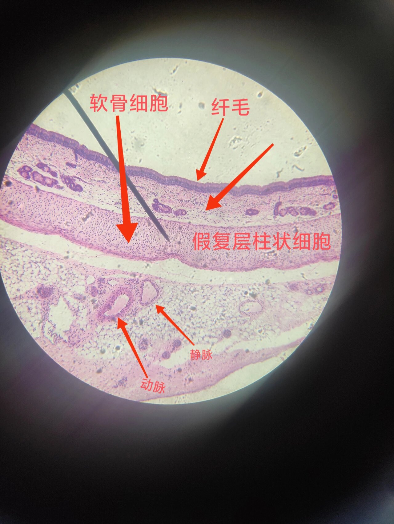 气管横切切片观察 要好好学组织学了,今天观察到切片好多都说不出来