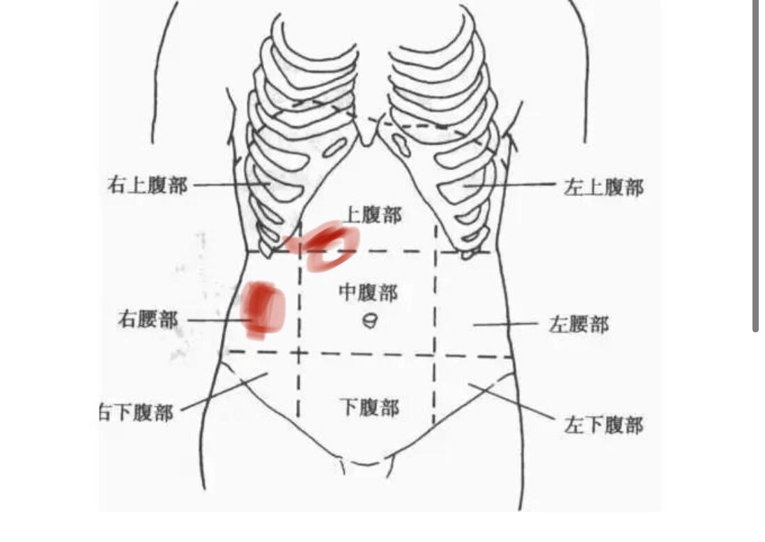 肋间神经痛会呼吸的痛 最近几天深呼吸右腹部如图红色的位置就会扯着