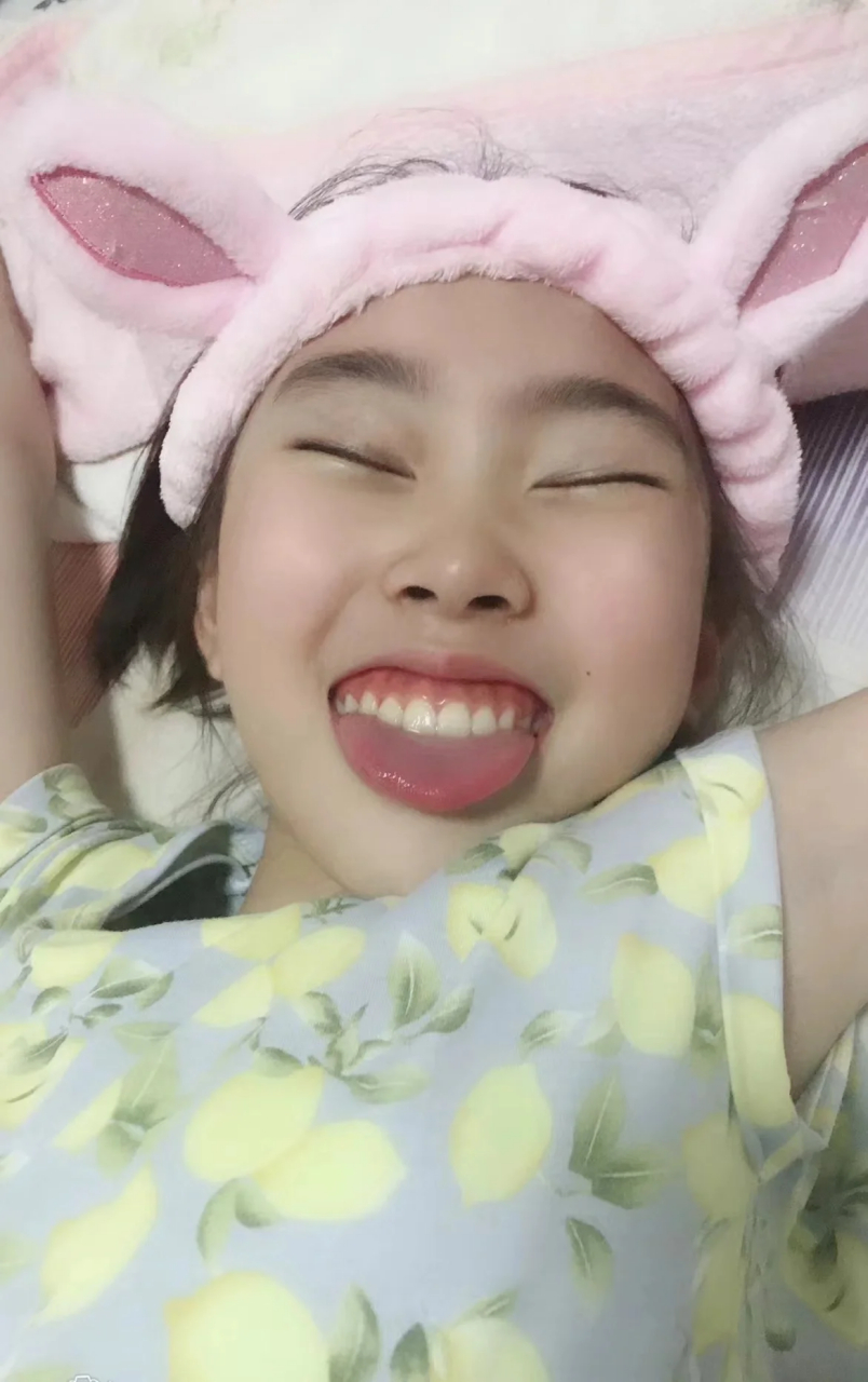 女儿在换牙前就有龅牙的趋势,但那个时候一直以为换完牙,脸长开了