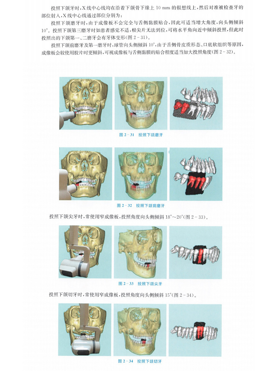 小牙片拍摄下颌牙齿投照角度图谱