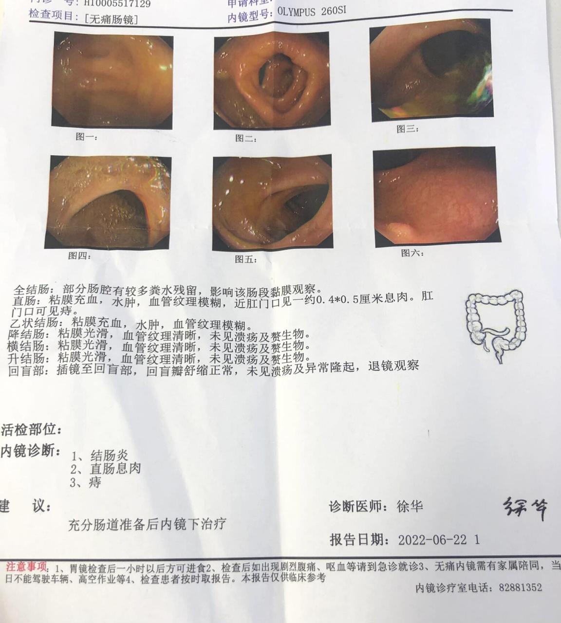 体检做指检时医生大姐说肛门口处有异物感,让我去医院再具体检查检查