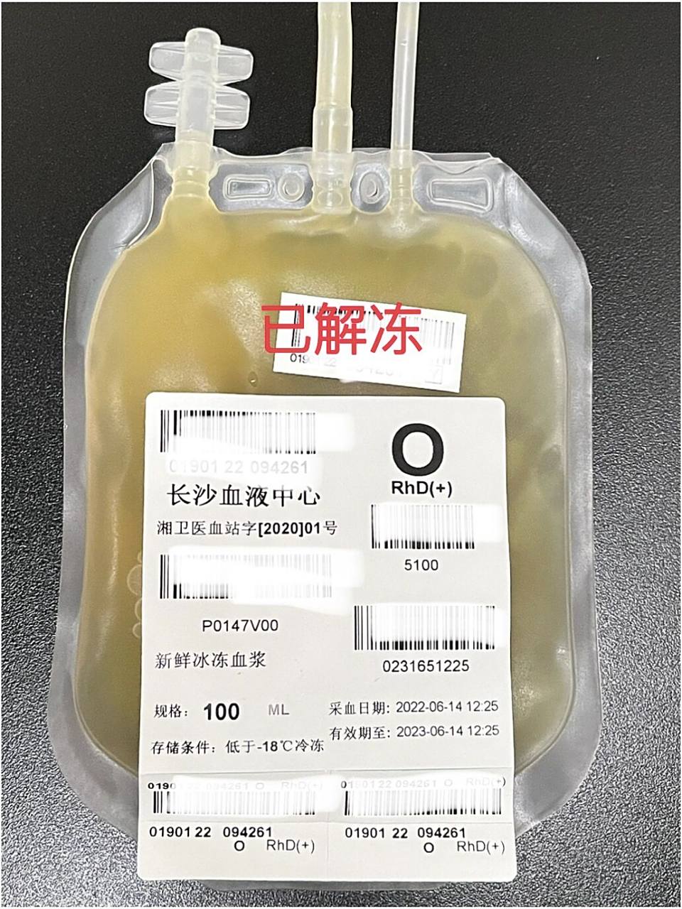 新鲜冰冻血浆 新鲜冰冻血浆(ffp):是由抗凝的新鲜全血于6小时内在4