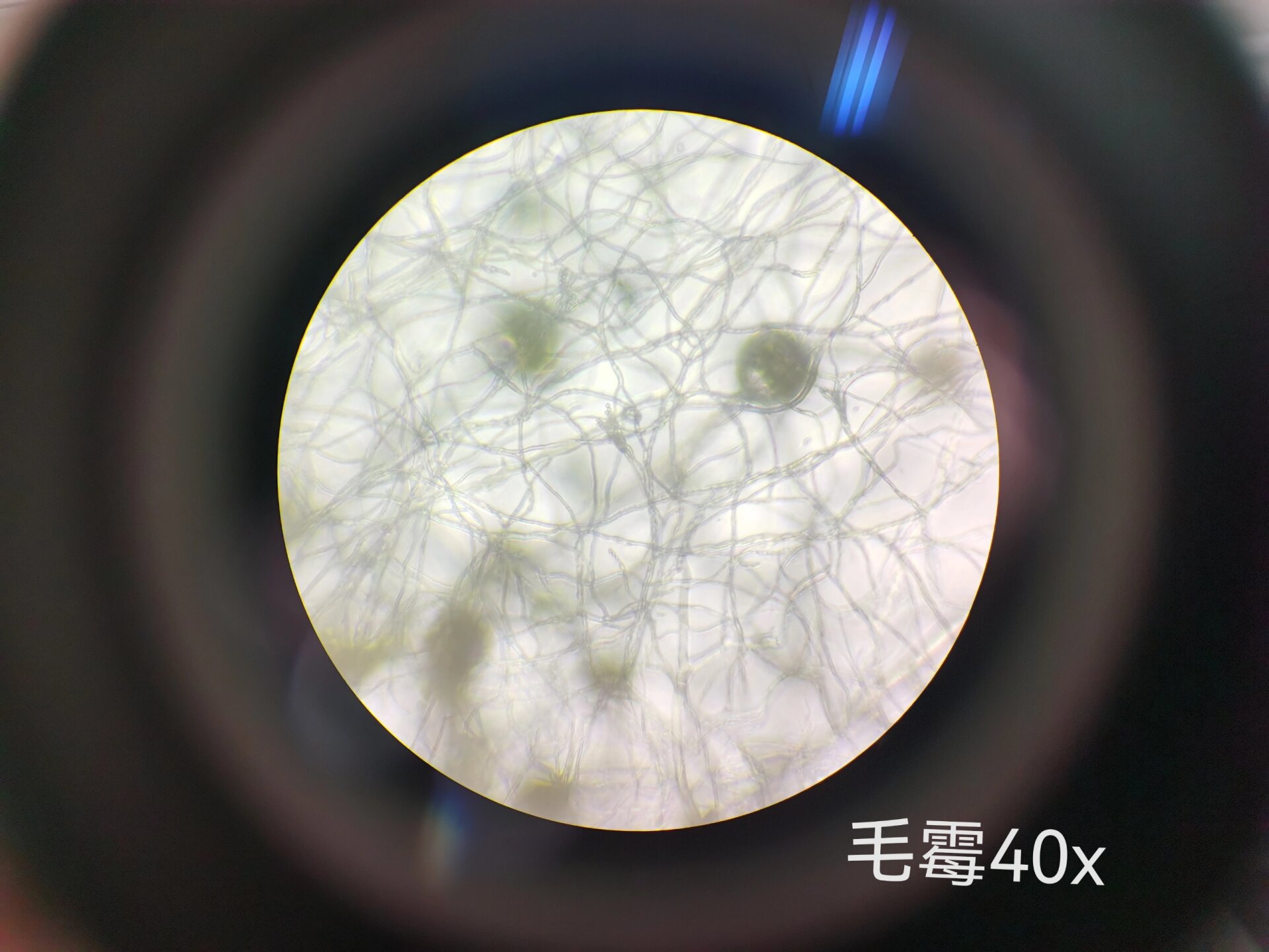 霉菌形态观察 根霉