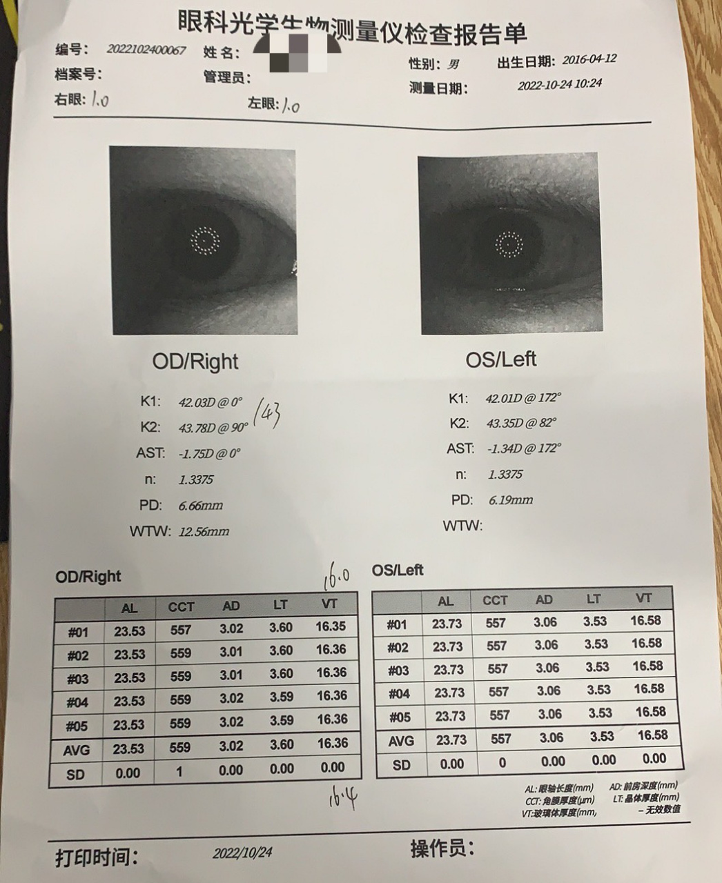 视力检查报告 孩子的视力检查报告,看不懂,有哪位能看懂的留言一下
