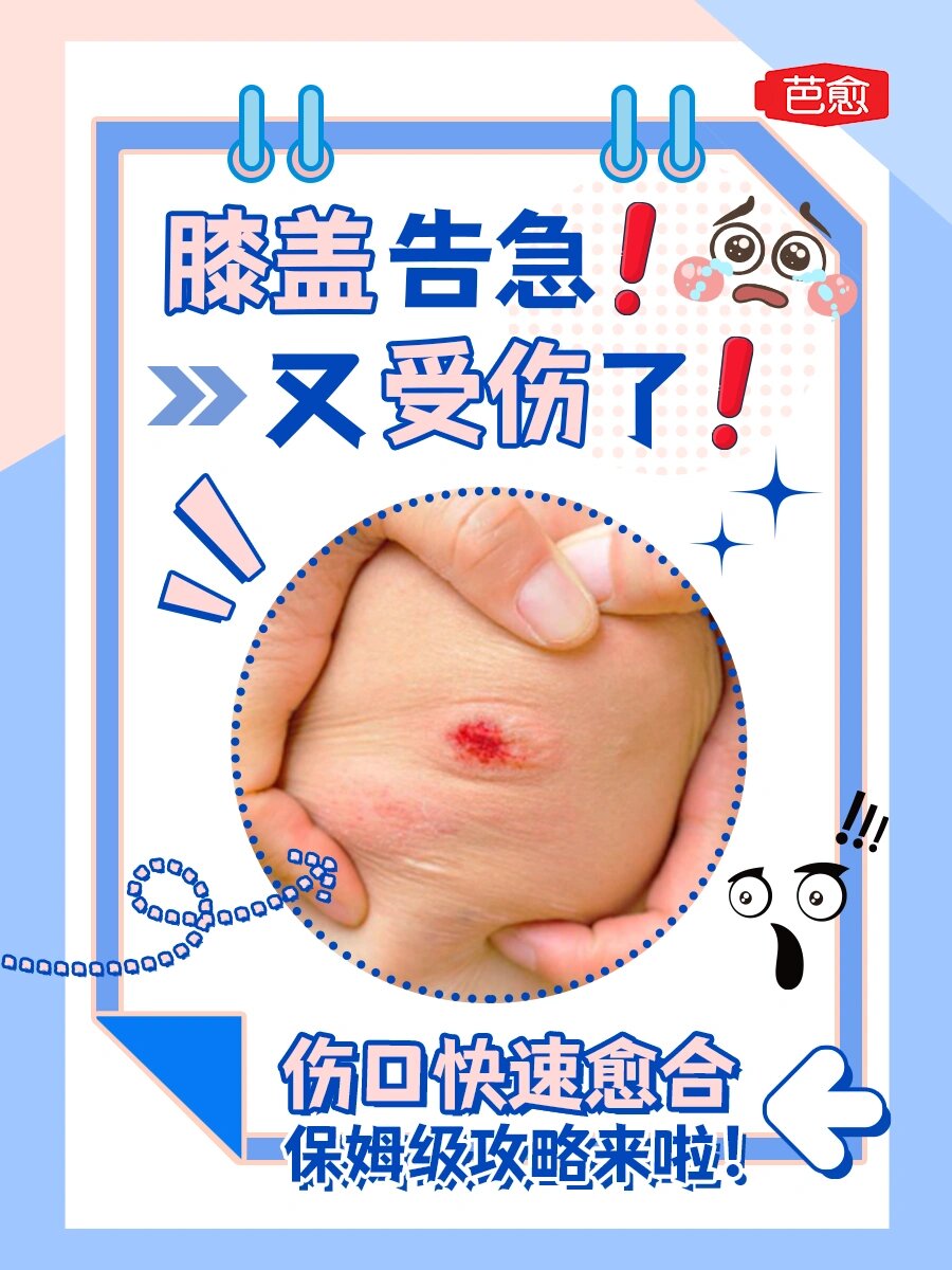 日常生活中最容易受伤的位置就是膝盖了 没仔细看路不小心摔伤 走楼梯