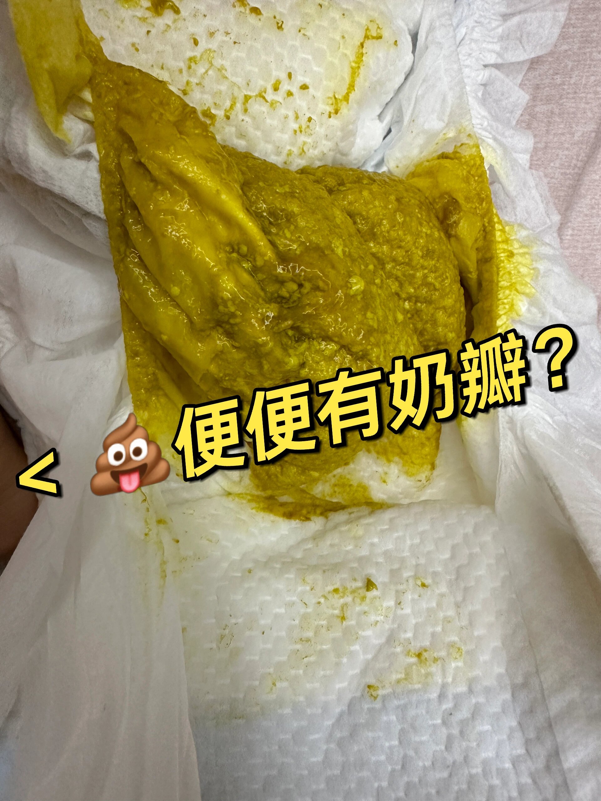 宝宝拉豆腐渣样大便图片