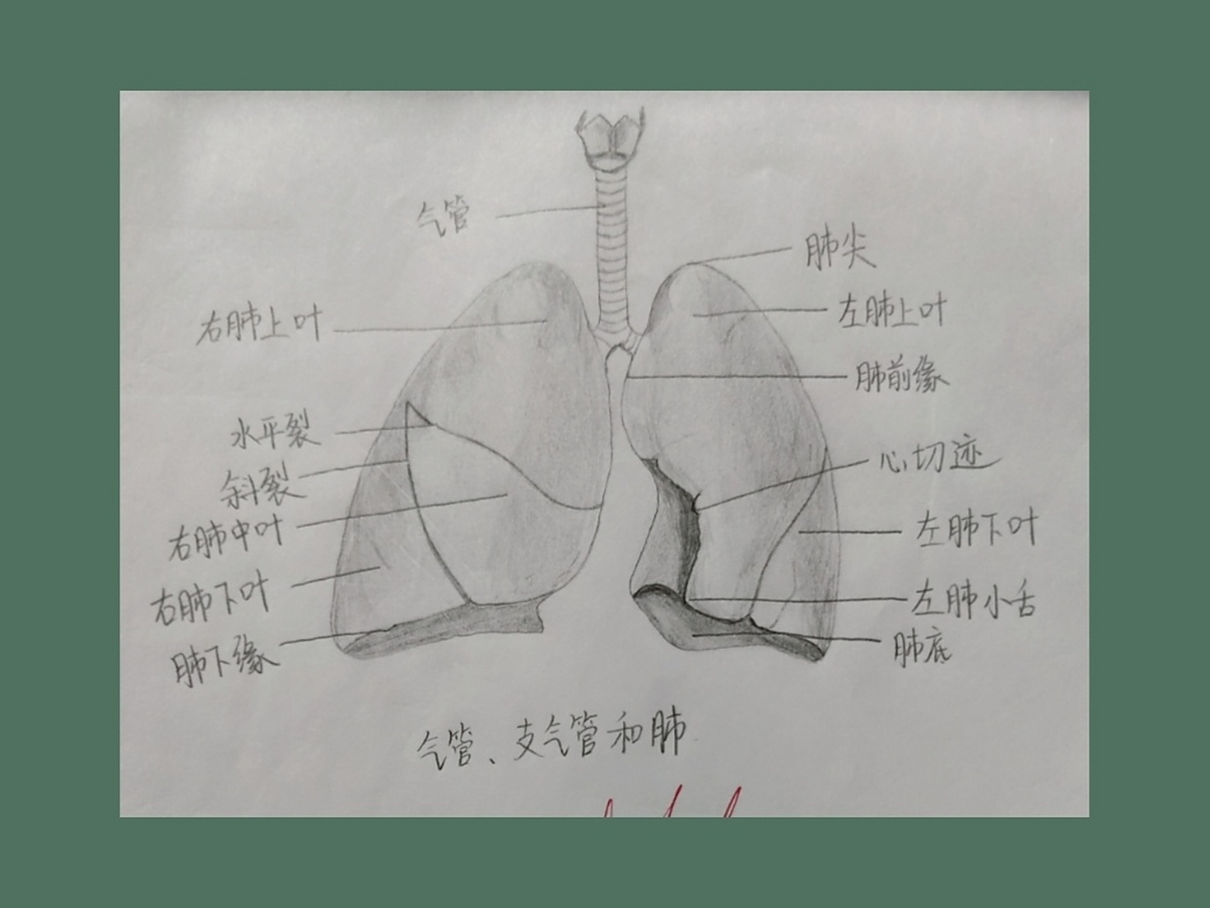 气管,支气管和肺解剖图