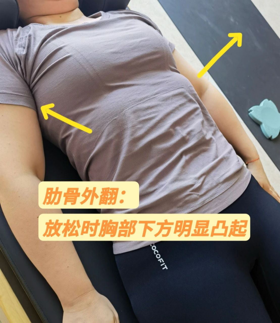 女生乳房下面肋骨突出图片