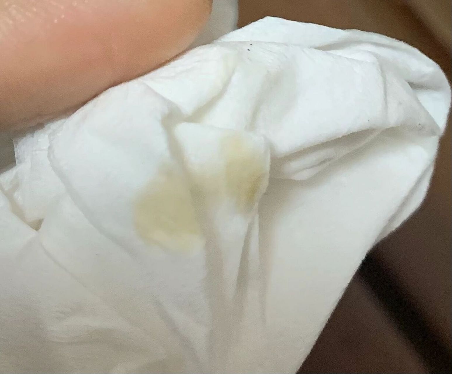 猫咪屁股出黄色的液体是怎么了 有没有人知道猫咪屁股上出黄色的水是