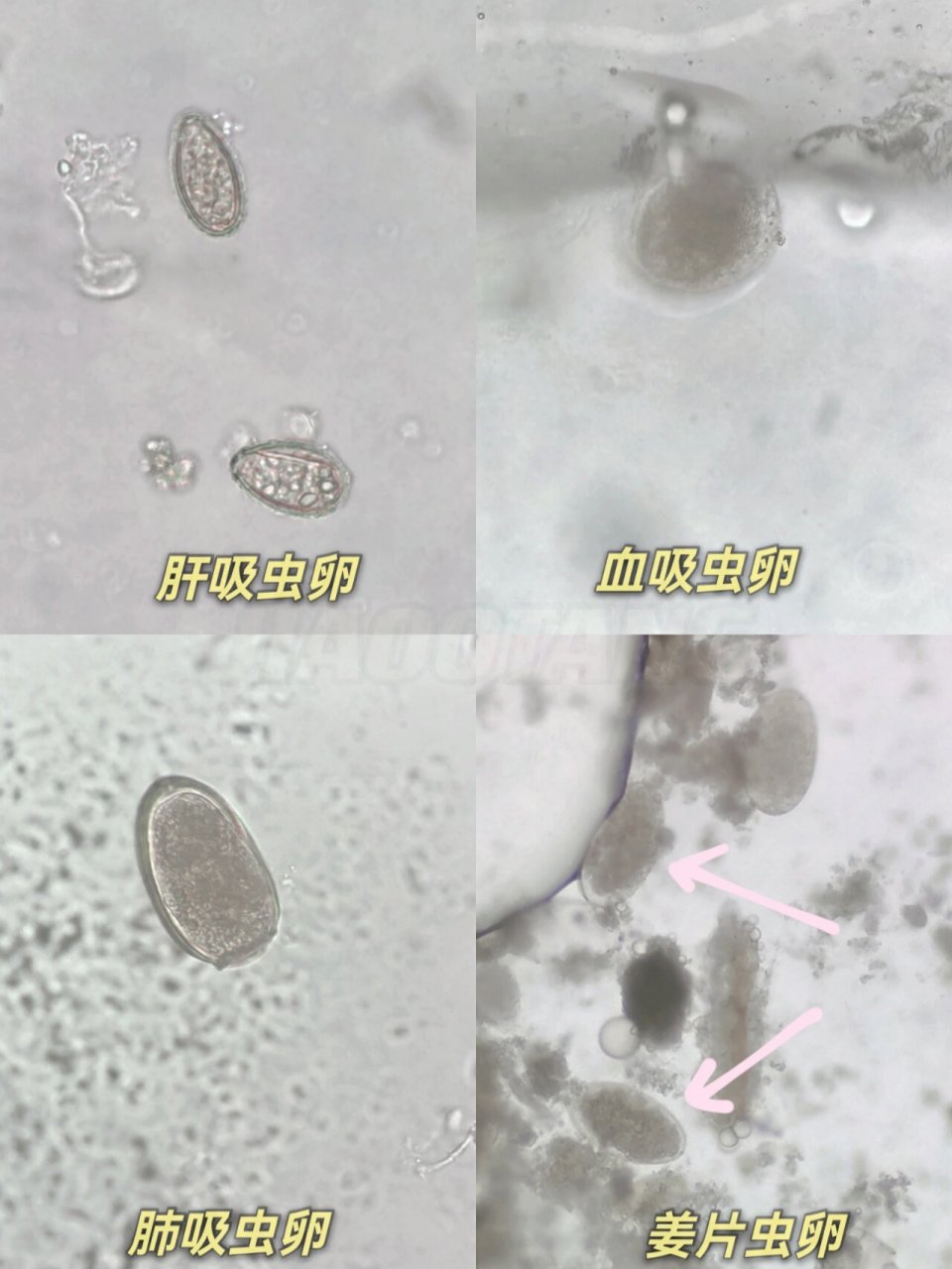 布氏姜片吸虫虫卵结构图片