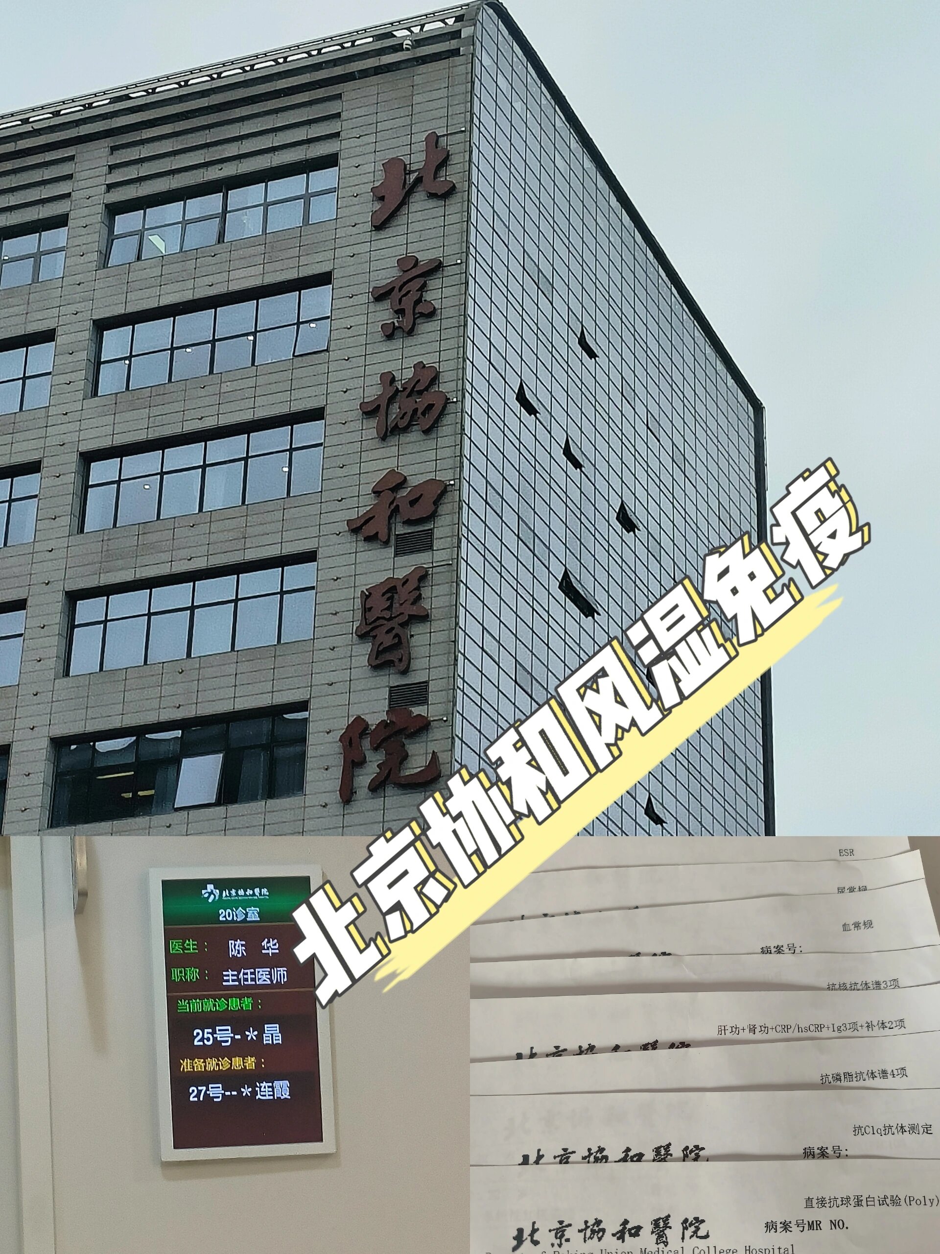 sle 北京协和国际医疗风湿免疫 面部红斑数月,空总皮肤科就诊后