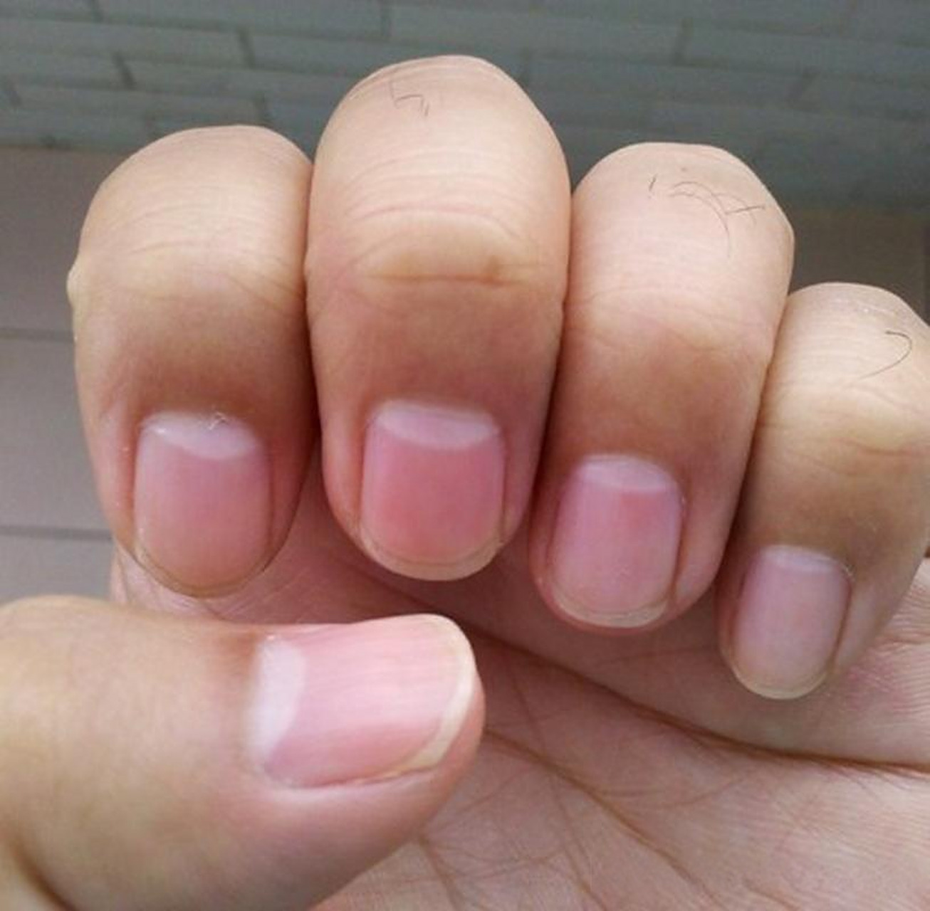 有些人天生就指甲月牙较小或不明显,这并不意味着他们身体不健康.