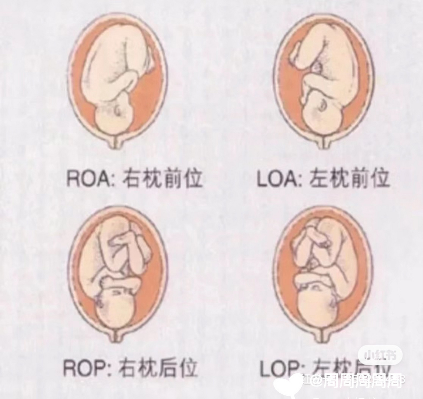 孕38周 4,右枕后位 今天的b超结果双顶径92,宝宝已经六斤半了,胎位是