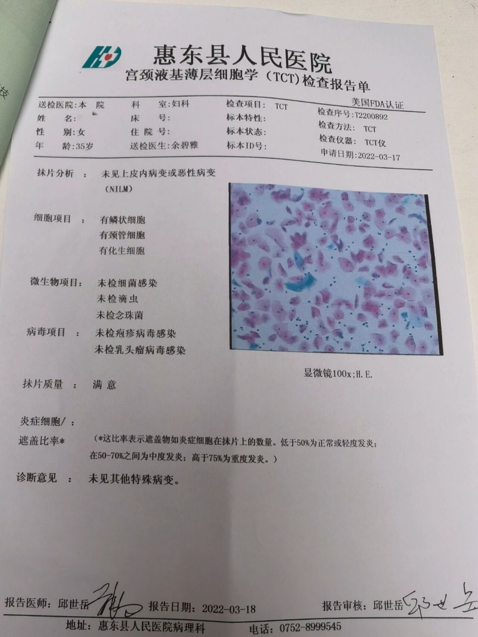 宫颈癌筛查 35岁第一次做宫颈癌筛查,结果阴性,太好了,hpv和tct一切