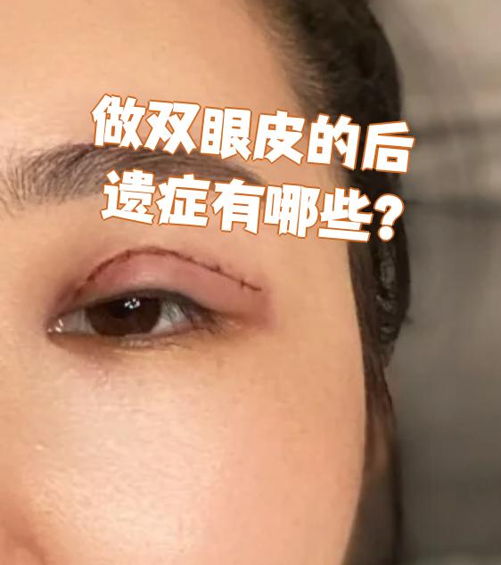 为什么双眼皮手术会肿为什么在线