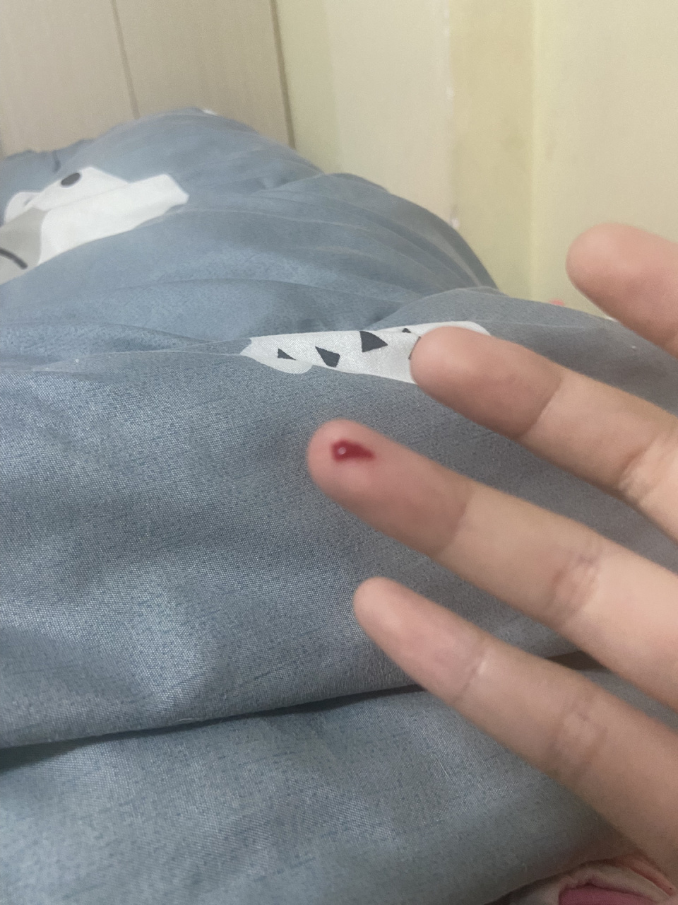 但是今天是一口咬下去把我咬出血了,这个需要打疫苗吗(还有,猫咬人
