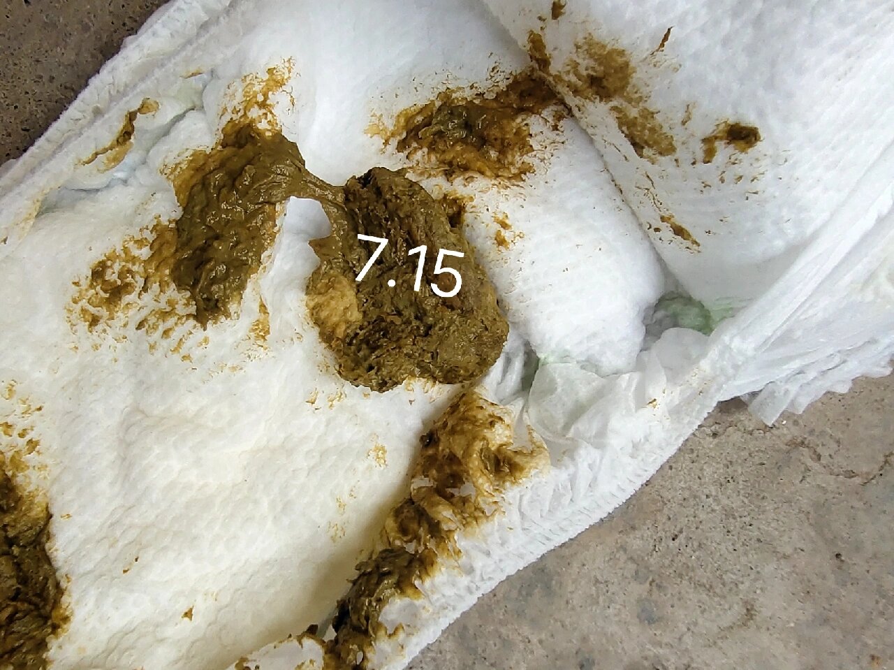 蔼儿舒第十二天,大便越来越好了(有便图)