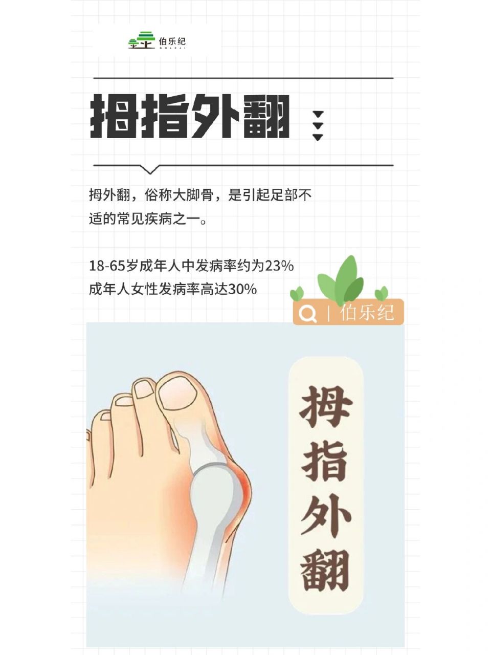 当脚趾的走向和第一掌骨的走向,其夹角大于15度,就称为拇趾外翻