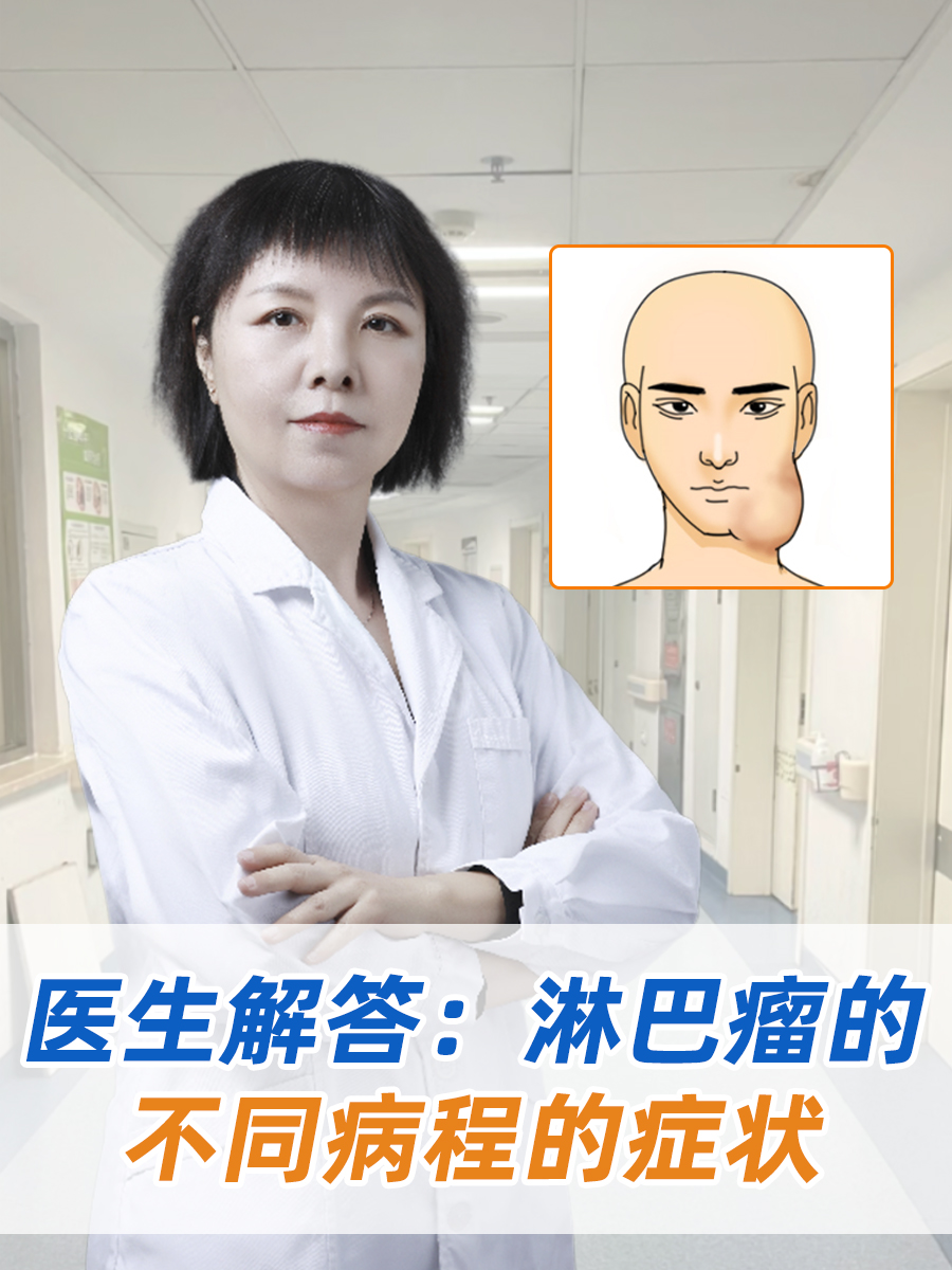 医生解答:淋巴瘤的不同病程的症状 淋巴瘤是一种淋巴系统的恶性肿瘤