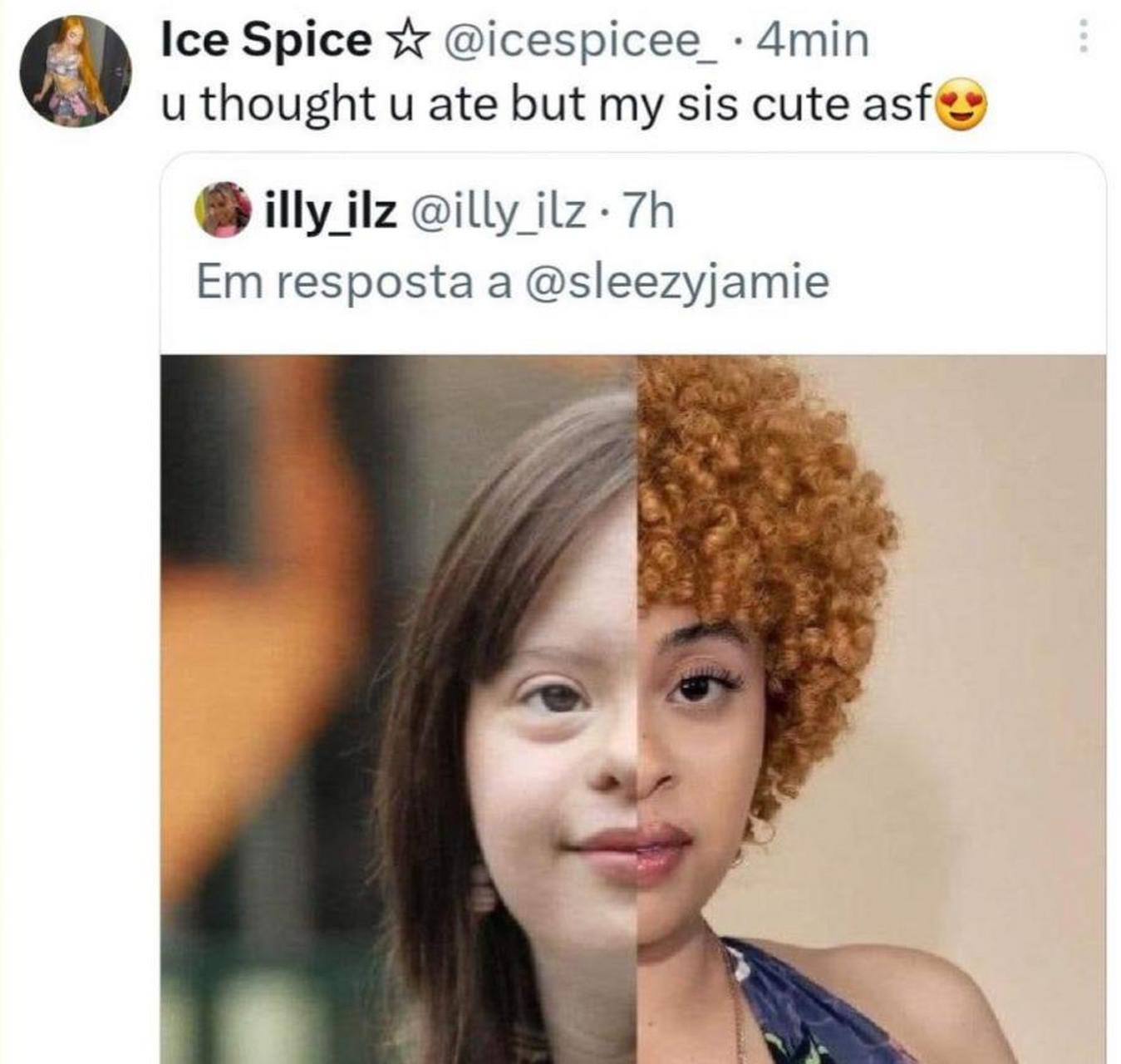 最近,一位黑粉攻击 ice spice 的长相,认为她长得像唐氏综合症的患者.