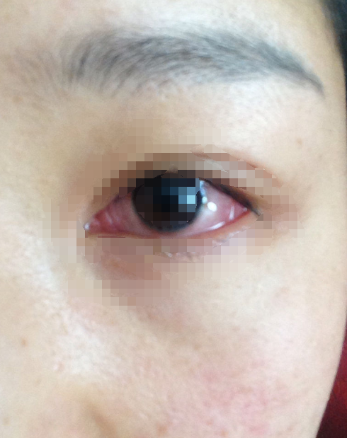  疫情后期症状有哪些表现(现在疫情是什么症状)