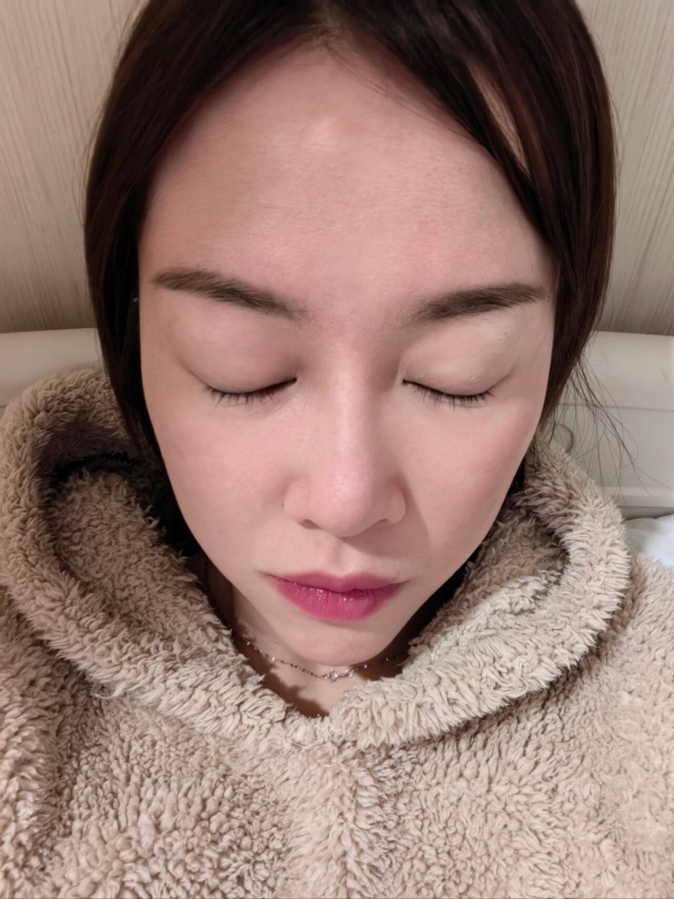 额骨骨瘤手术恢复中 希望不要复发了