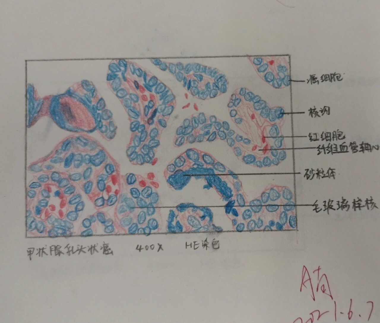 甲状腺切片手绘图图片