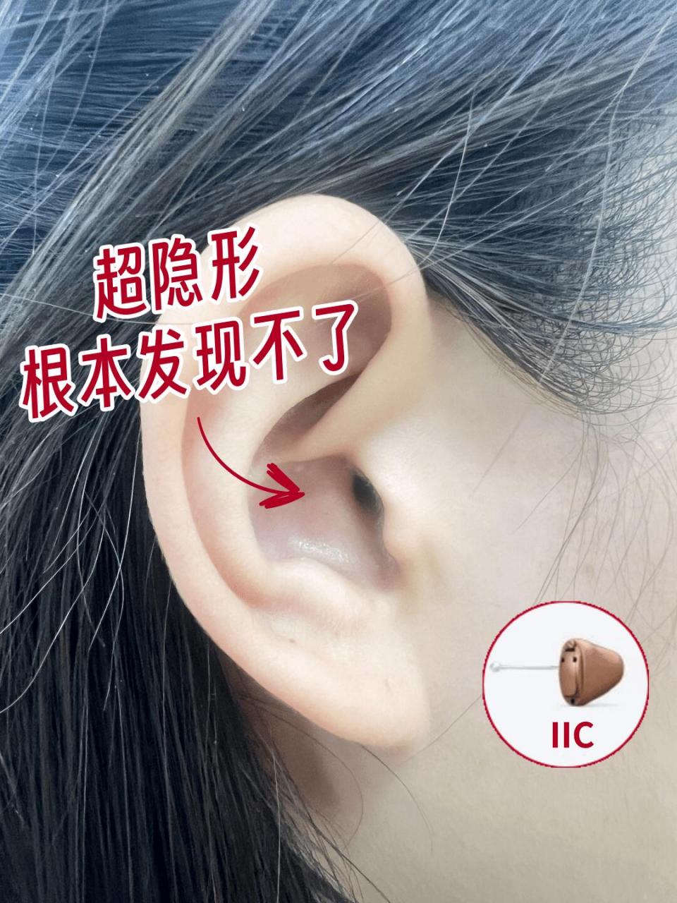 超隐形助听器 隐形深耳道式助听器iic: ✅外观最小的助听器,较深耳