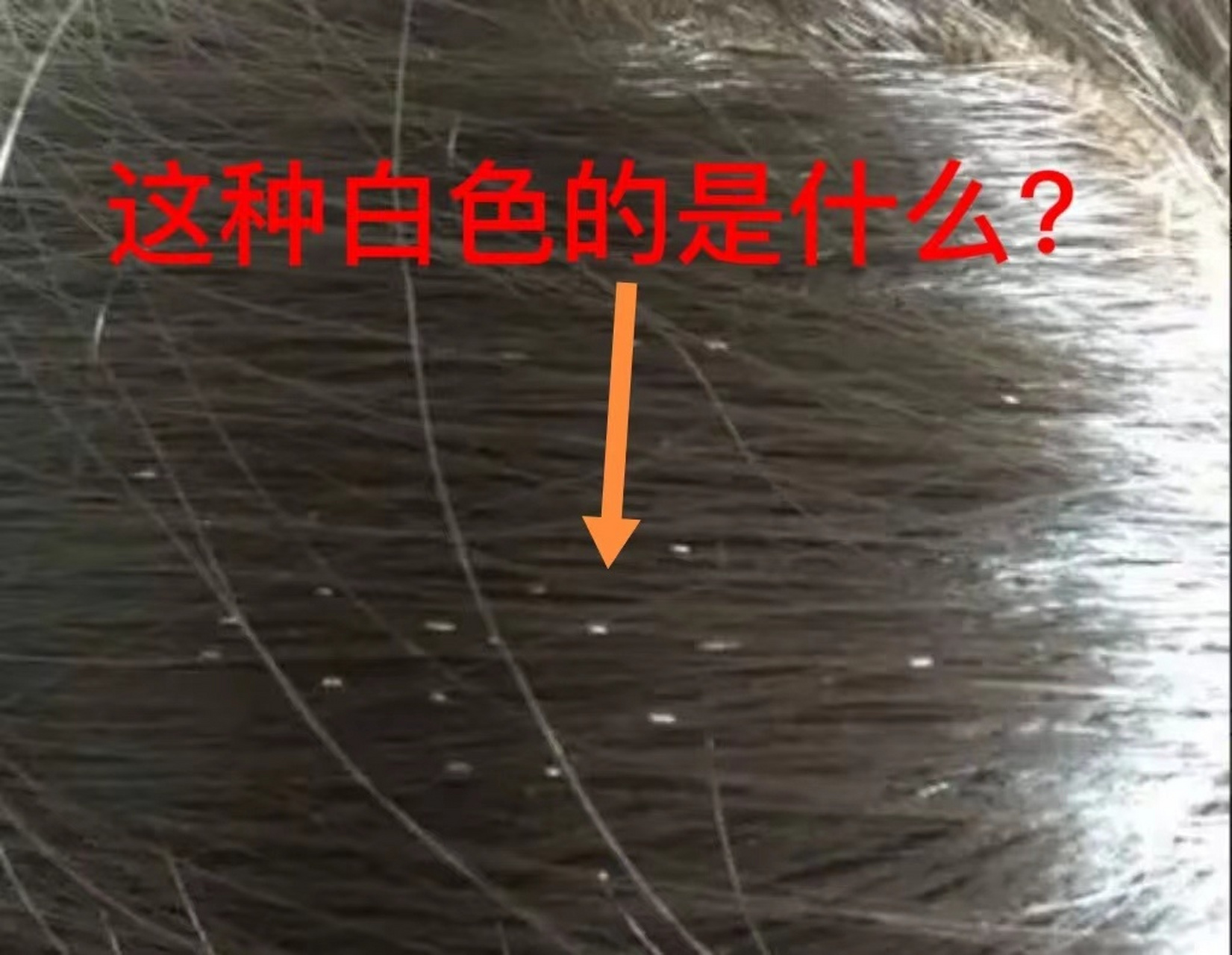 头发上附着的白色管状物是什么?