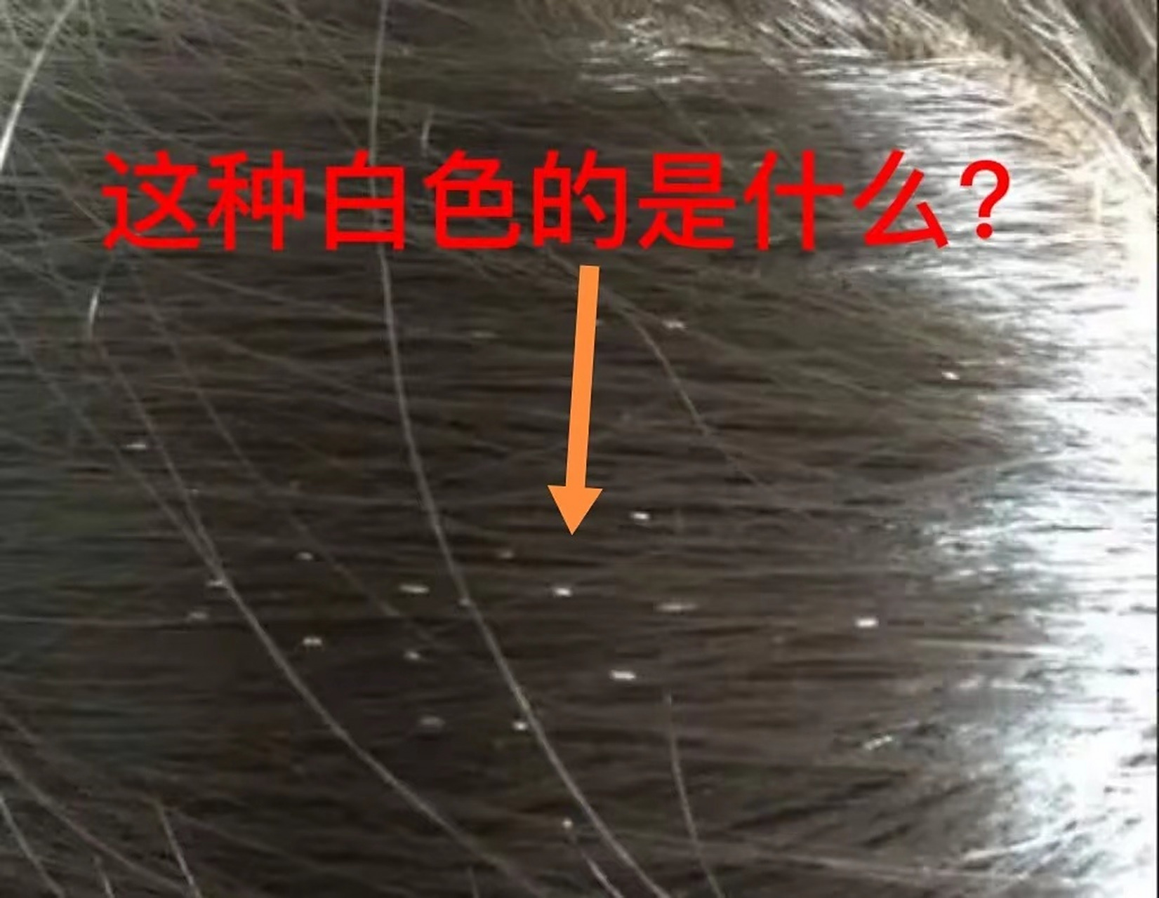 头发上附着的白色管状物是什么?