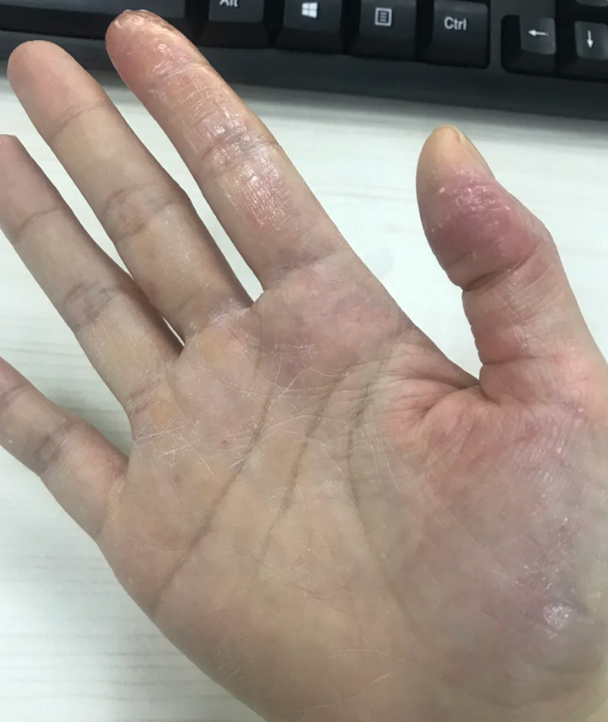 我们先来看看常见的几种可能性